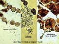 Didymium melanospermum-amf1981-micro
